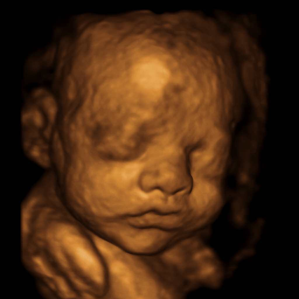3D sĂŒĂes Ultraschallbild personalisiert â mit Namen, Datum & Schwangerschaftswoche
