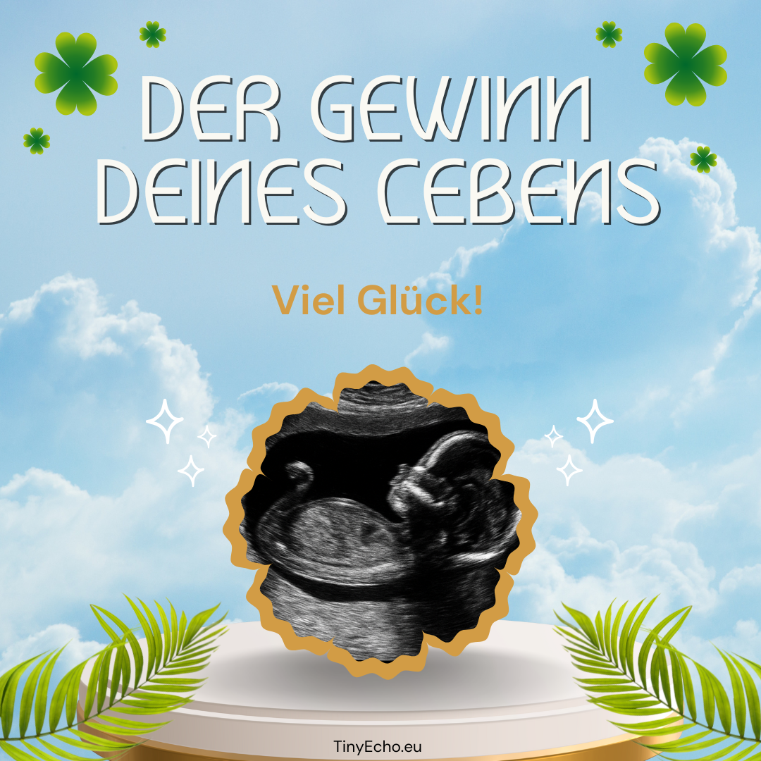 Schwangerschafts-Rubbelkarte â SchwangerschaftsÂ-Announcement mit Ultraschallfoto